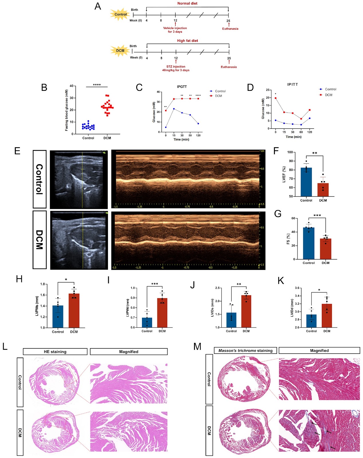 Inhibition of HMOX1 alleviates diabetic cardiomyopathy by targeting ferroptosis