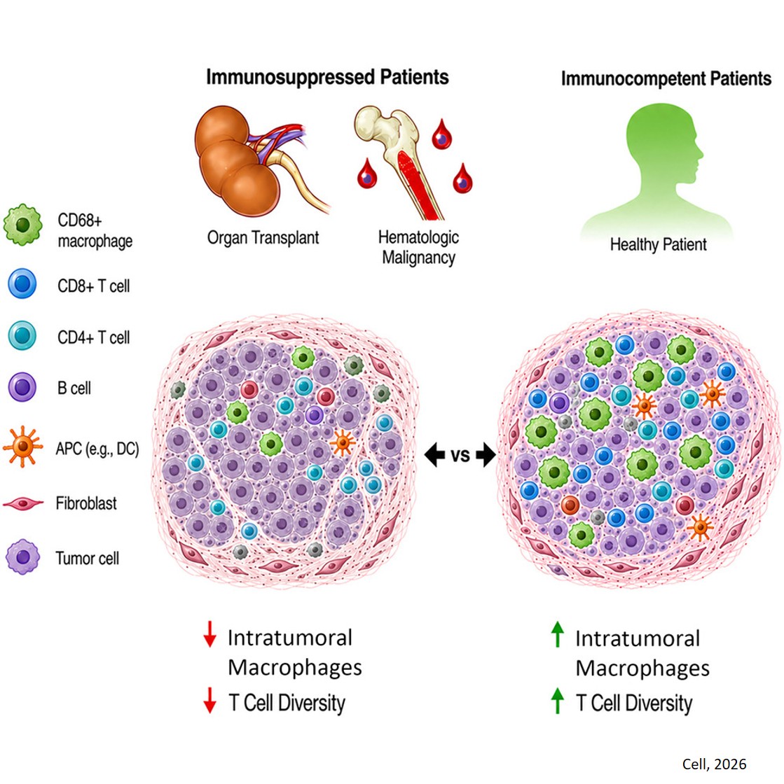 Immune cell dysfunction, not absence, defines skin cancer in immunosuppressed patients