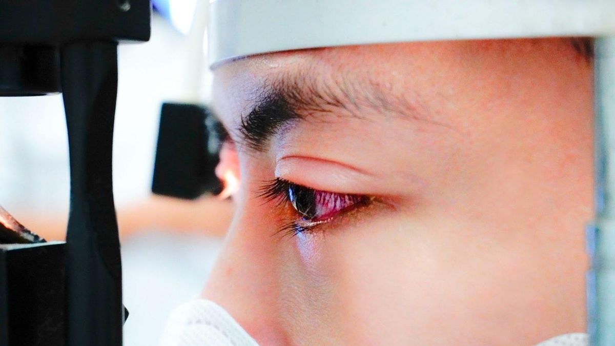Bệnh đau mắt đỏ gia tăng, Bộ Y tế đưa ra 7 cảnh báo - Đài Phát thanh và truyền hình Hà Nội