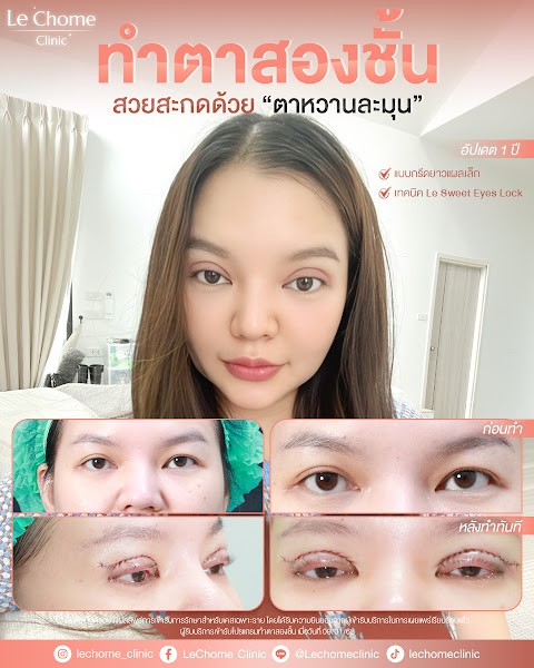 ตา 2 ชั้น