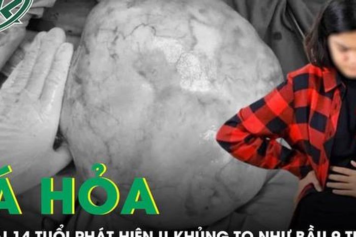 Bé gái 14 tuổi bụng to như bầu 9 tháng, bác sĩ phát hiện u khủng - Báo Sức Khỏe &amp; Đời Sống