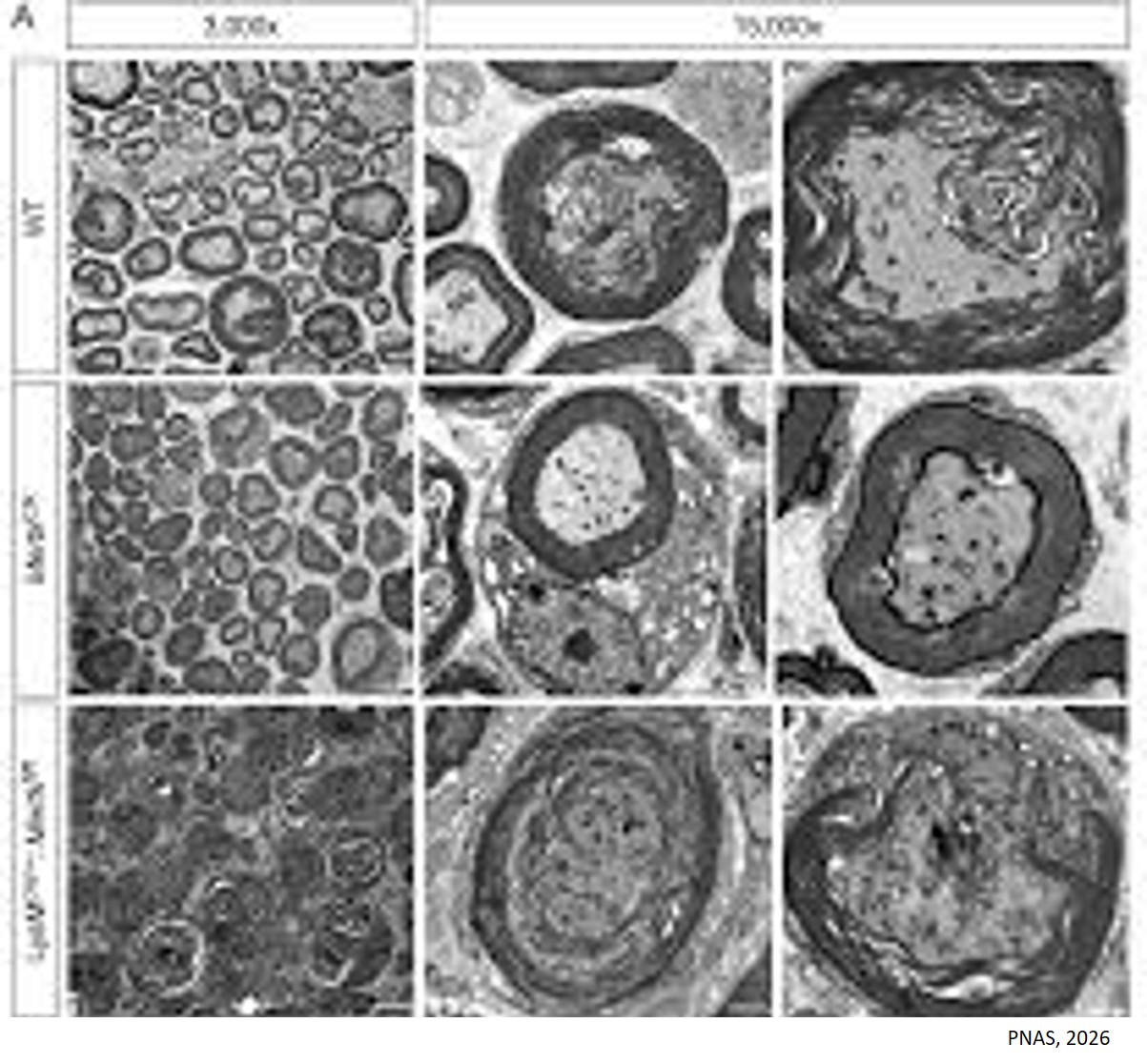 How peripheral nerve injury causes neuropathic pain