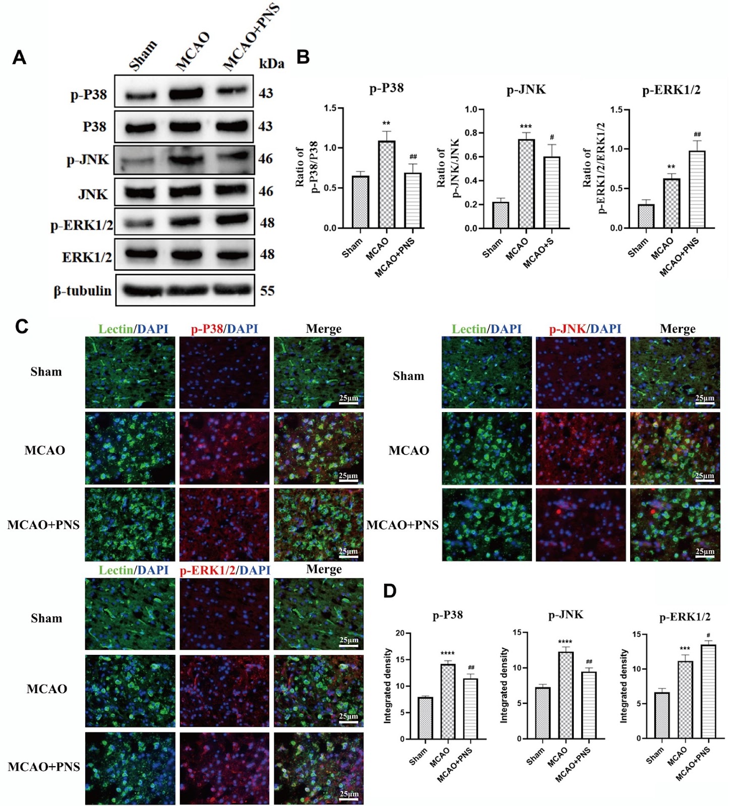 Exploring the mechanism of Panax notoginseng saponin in inhibiting the inflammatory response of microglia in cerebral ischemia based on network pharmacology