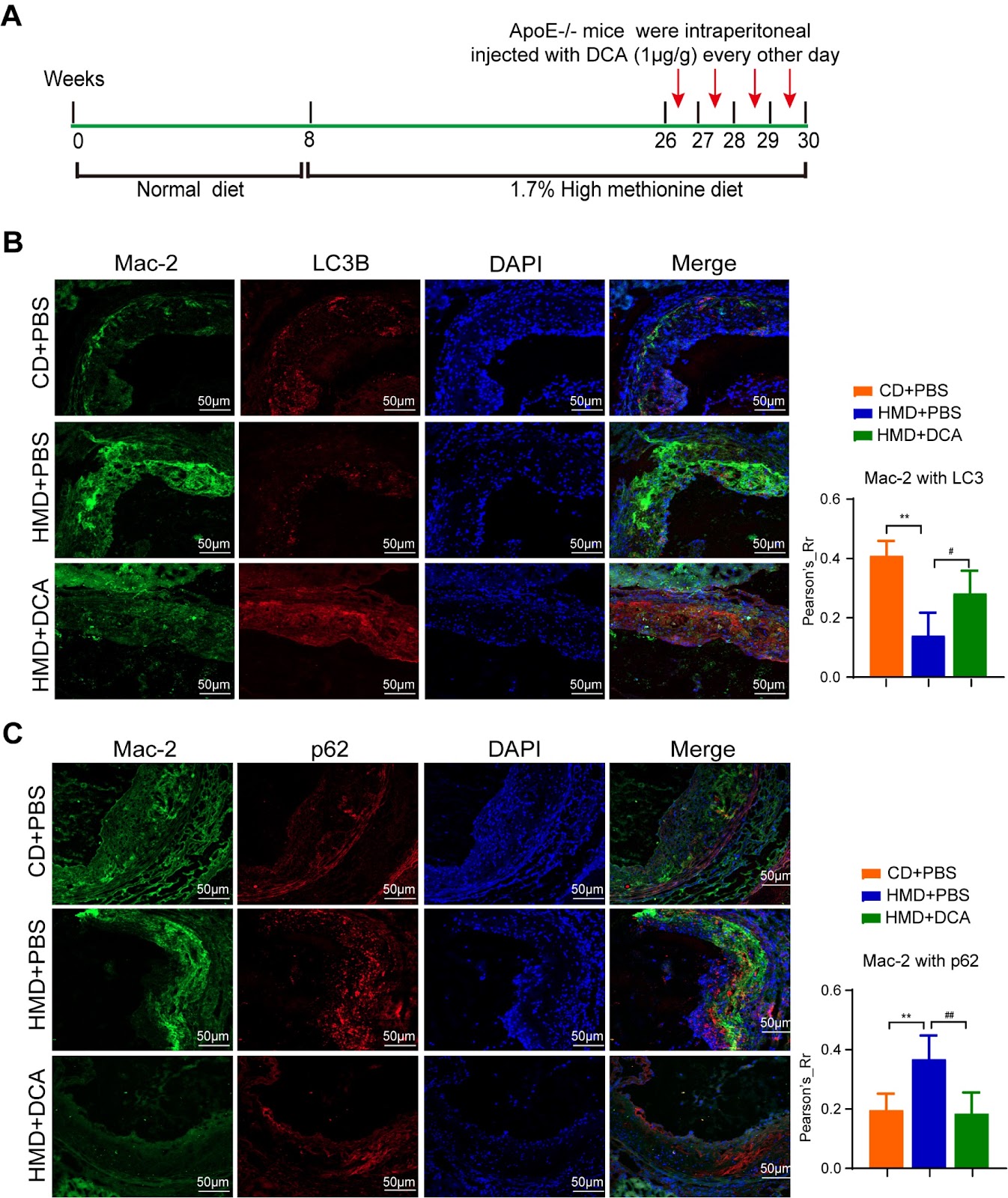 Pyruvate dehydrogenase alleviates macrophage autophagy in Hcy-induced ApoE–/– mice