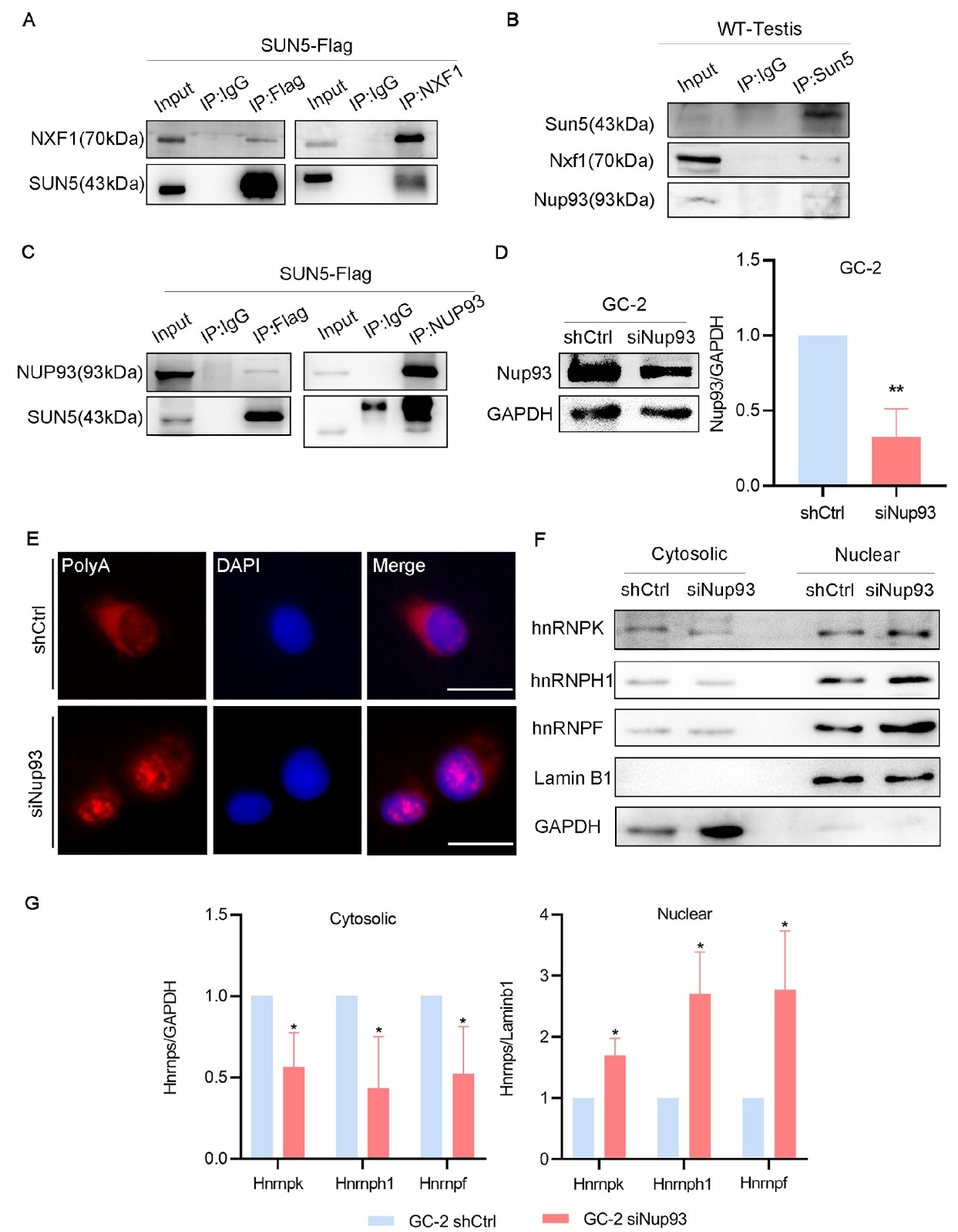 SUN5, a testis-specific nuclear membrane protein, participates in recruitment and export of nuclear mRNA in spermatogenesis
