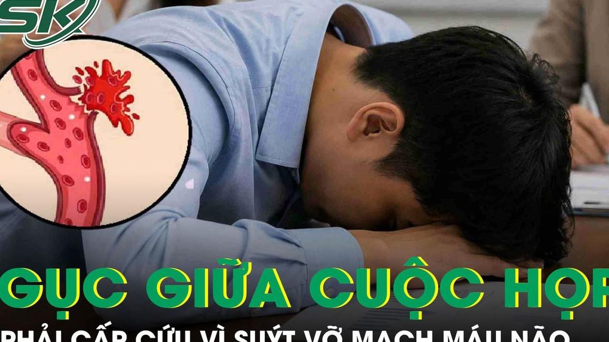 Nam thanh niên 29 tuổi bất ngờ gục giữa cuộc họp giao ban sáng, suýt vỡ mạch máu não - Báo Sức Khỏe &amp; Đời Sống