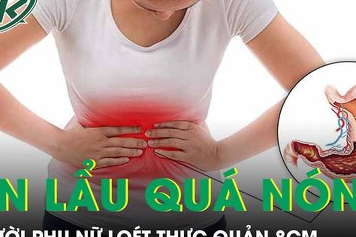 Người phụ nữ loét thực quản 8cm vì thói quen ăn lẩu quá nóng - Báo Sức Khỏe &amp; Đời Sống
