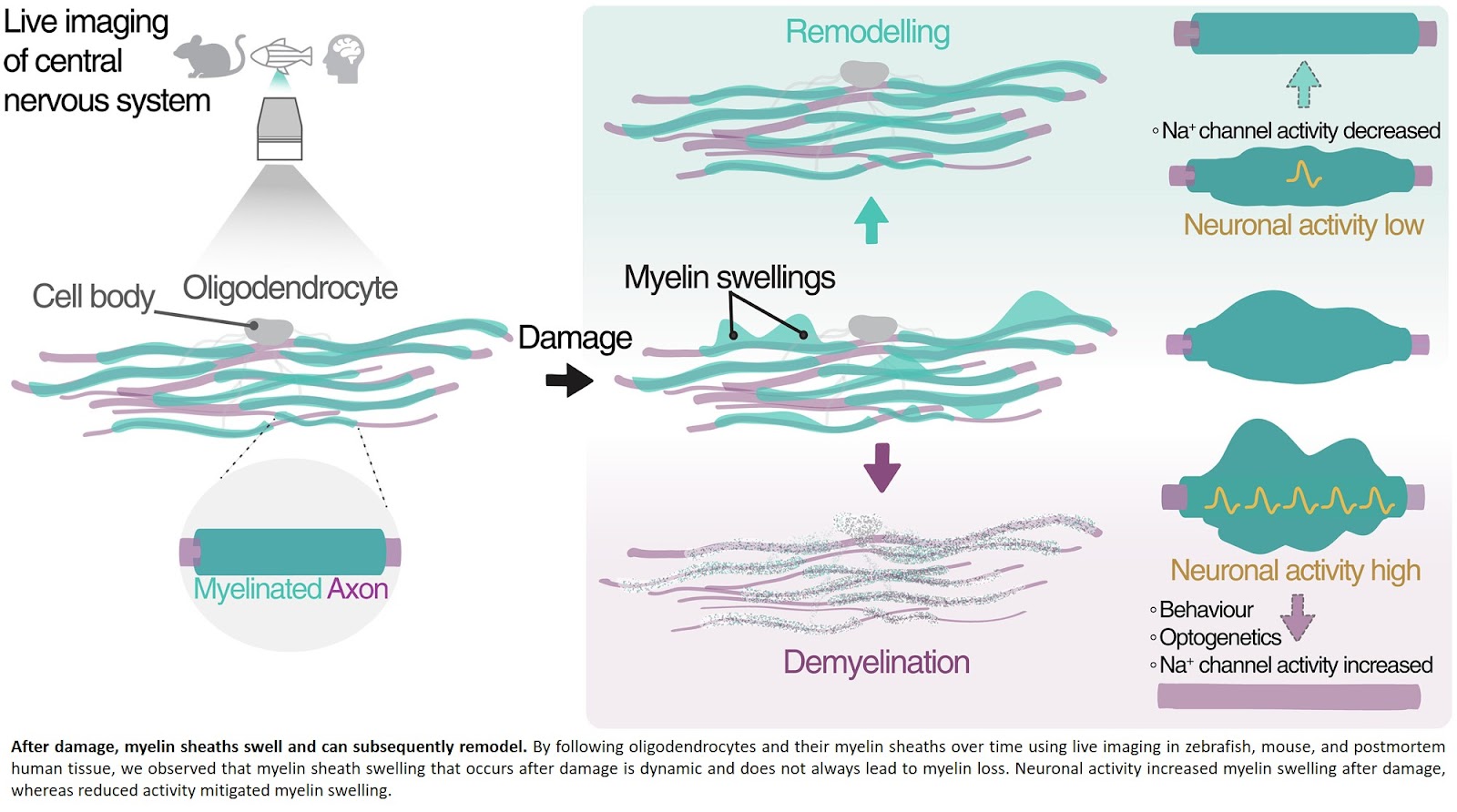 The dynamics of myelin swellings