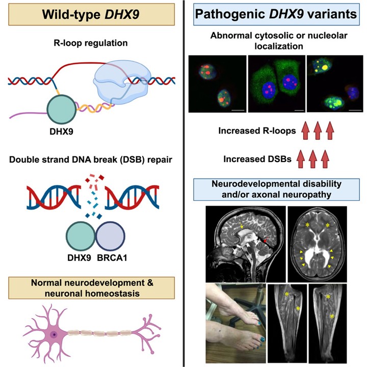 Deciphering DHX9 gene pathogenicity in neurological disorders with distinct phenotypes