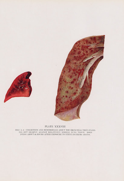 Plate XXXVIII Figs 8 9 Congestion and hemorrhage about the bronchial tree standi