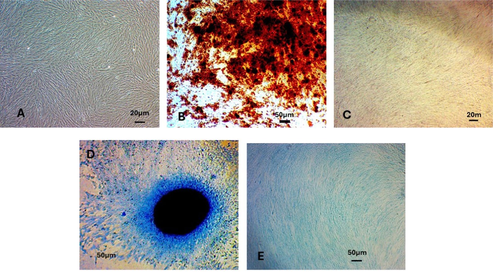 A phase I, open-label study of intravenous human dental pulp stem cells (NestaCell®) at two dose levels in patients with Huntington’s disease