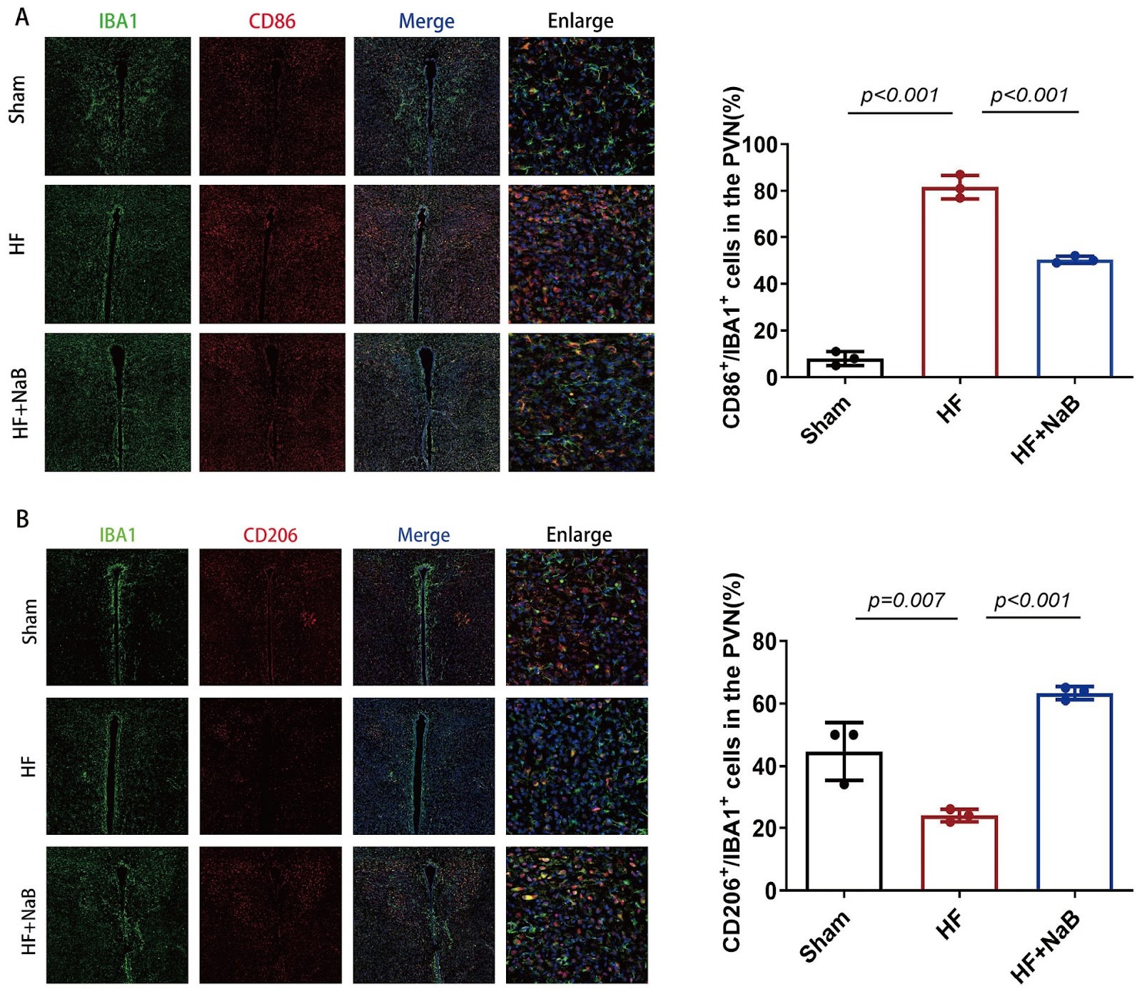 Butyrate attenuates sympathetic activation in rats with chronic heart failure by inhibiting microglial inflammation in the paraventricular nucleus