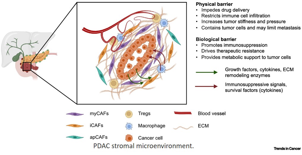 Precision targeting of stromal states in pancreatic cancer: a clinical perspective