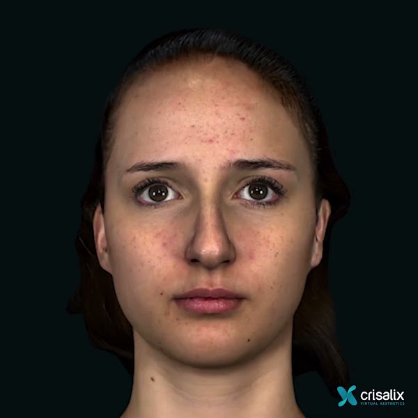 3D face