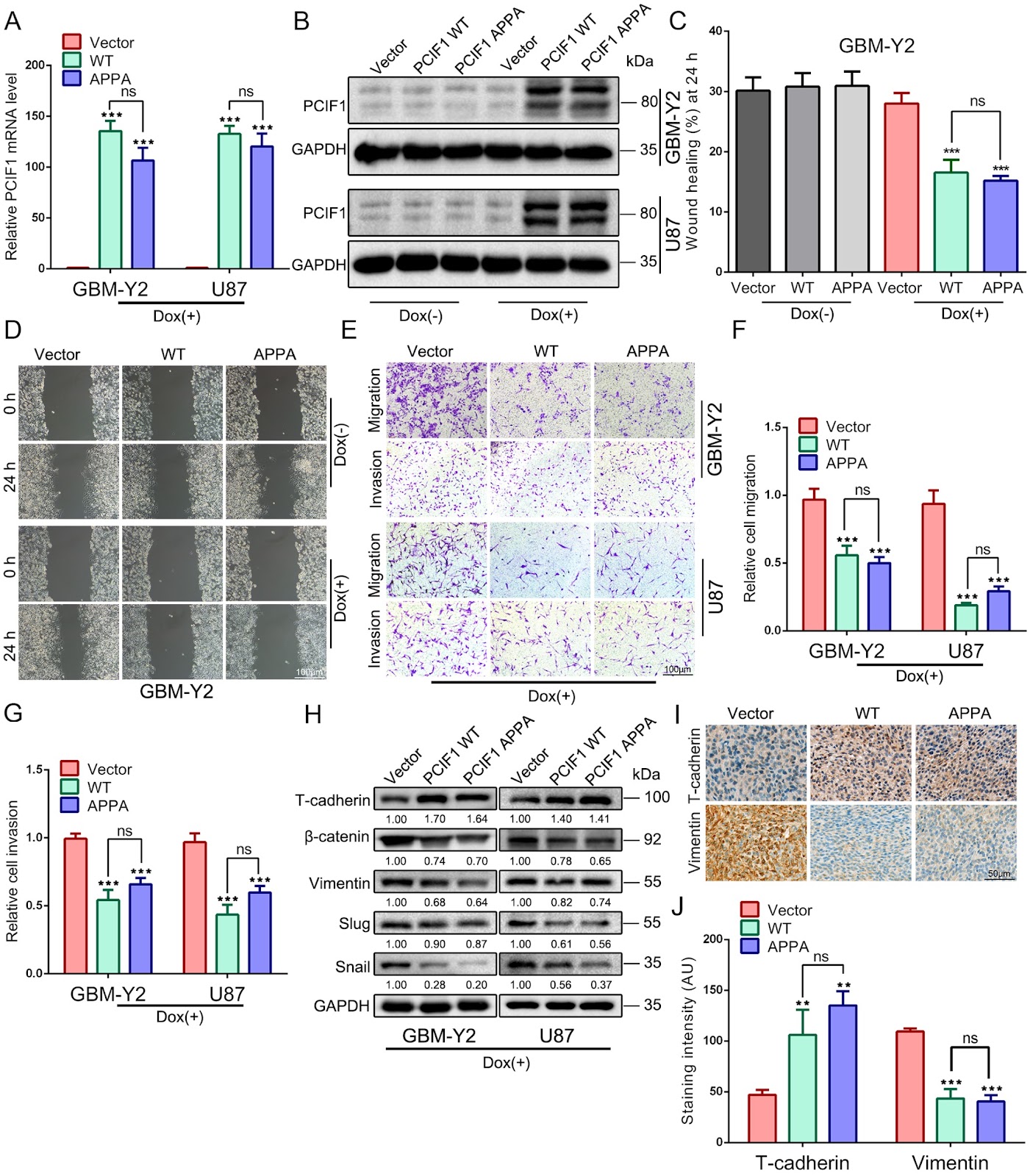 PCIF1 modulates glioblastoma cell migration and invasion by altering PI(3,4)P2 levels through the PI5-phosphatase INPP5B