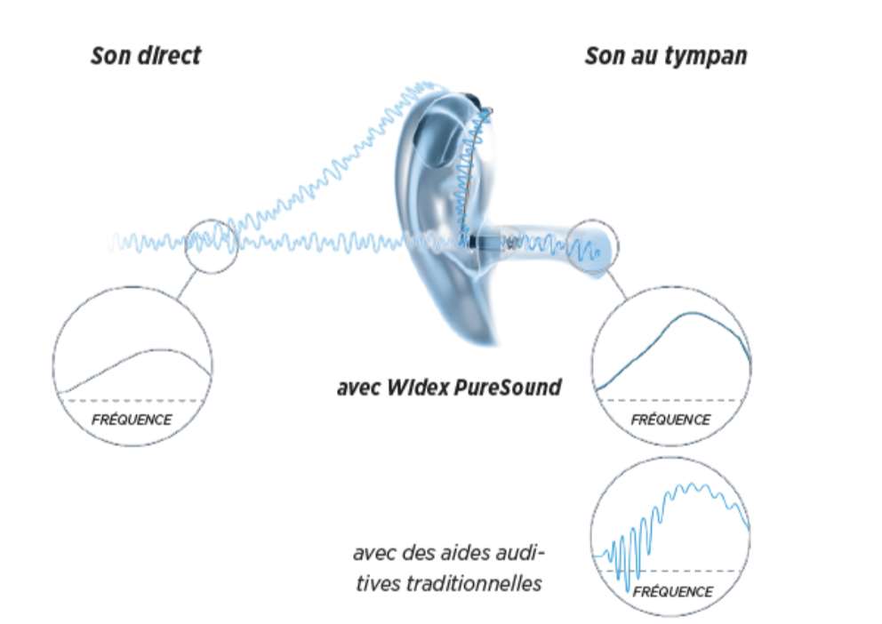 Mesure du délai de traitement et effet de filtre en peigne avec Widex PureSound ZeroDelay