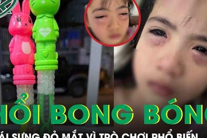Chơi bong bóng xà phòng, bé gái 5 tuổi sưng đỏ 2 mắt phải cấp cứu khẩn - Báo Sức Khỏe &amp; Đời Sống
