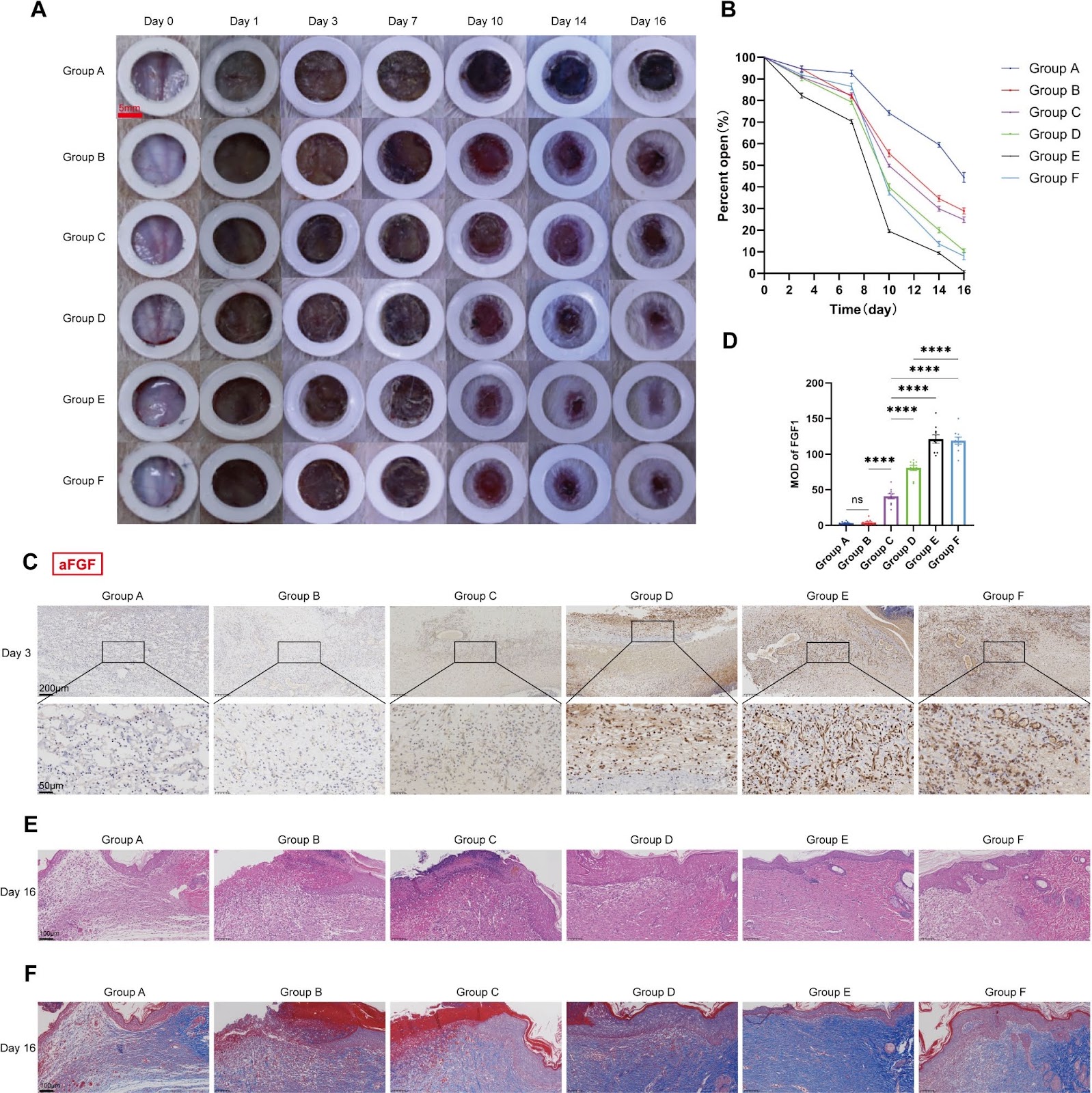 aFGF gene-modified adipose-derived mesenchymal stem cells promote healing of full-thickness skin defects in diabetic rats