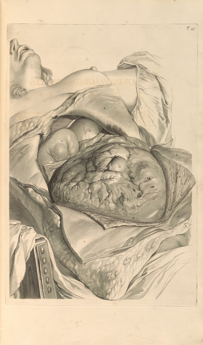 Anatomia humani corporis Pl056 1685