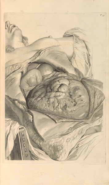 Anatomia humani corporis Pl056 1685