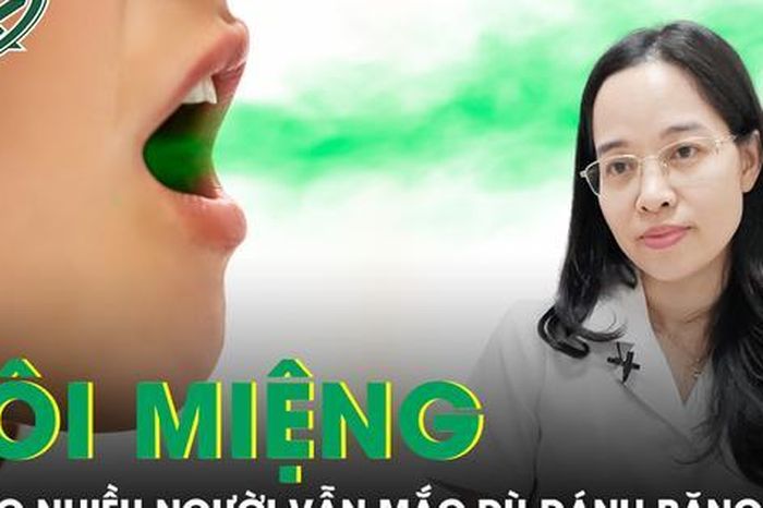 Vì sao nhiều người vẫn mắc bệnh hôi miệng dù đánh răng thường xuyên? - Báo Sức Khỏe &amp; Đời Sống
