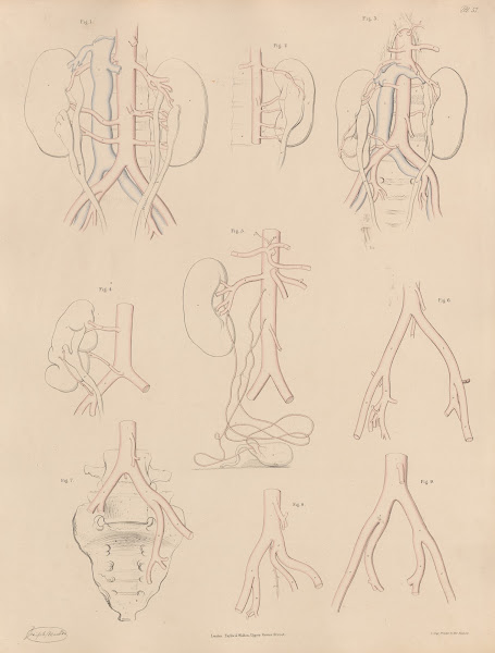 Peculiarities of some of the branches of the Abdominal Aorta and of the Iliac ar