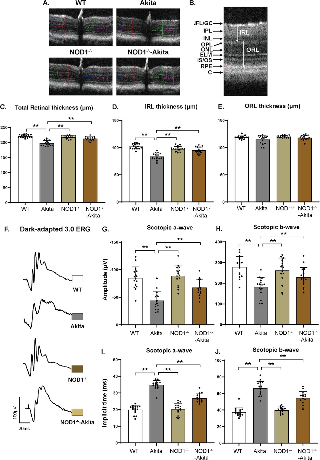 NOD1 deficiency ameliorates the progression of diabetic retinopathy by modulating bone marrow–retina crosstalk