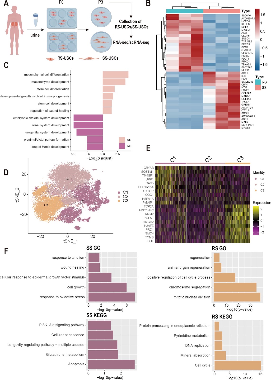 Human spindle-shaped urine-derived stem cell exosomes alleviate severe fatty liver ischemia–reperfusion injury by inhibiting ferroptosis via GPX4