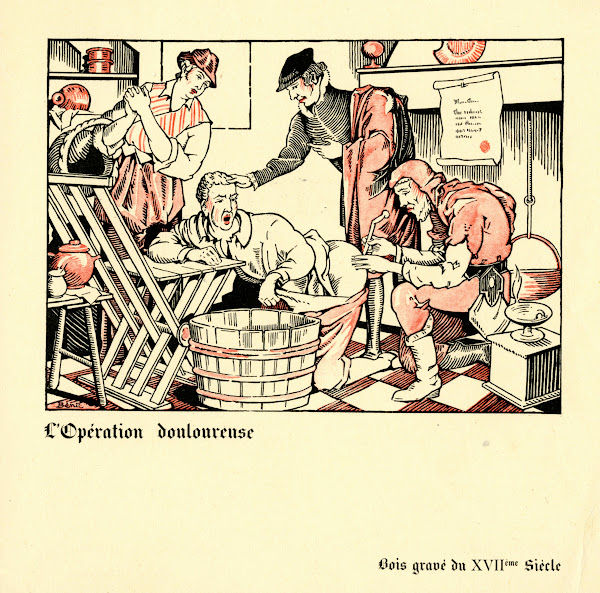 LopéRation Douloureuse