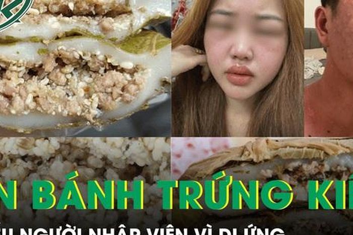 Trào lưu ăn bánh trứng kiến gây sốt mạng xã hội, nhiều người nhập viện vì dị ứng - Báo Sức Khỏe &amp; Đời Sống