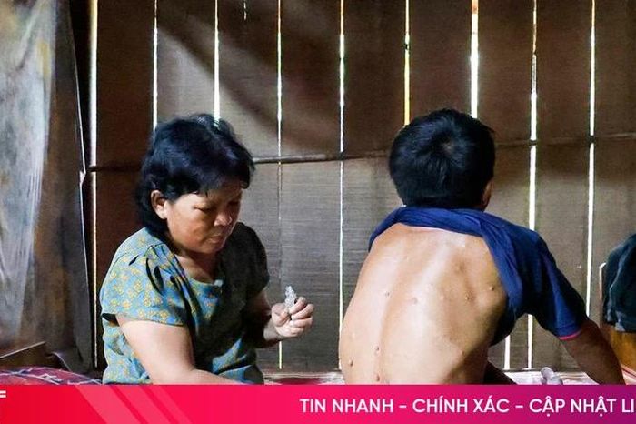 Vòng tay nhân ái: Nghẹn lòng cảnh vợ ung thư chăm chồng bị di chứng chất độc da cam - Báo Hà Tĩnh