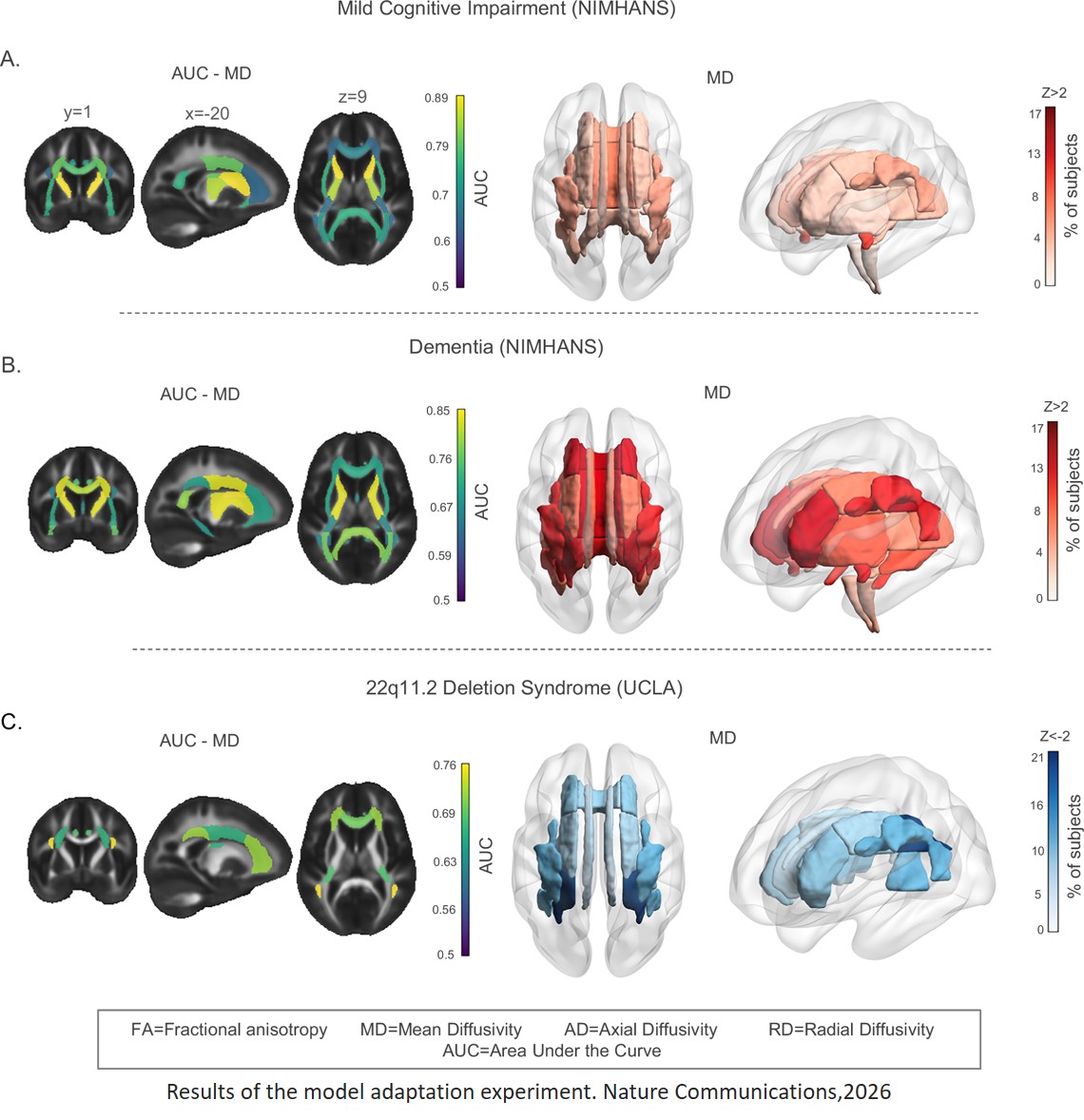 Lifespan normative modeling of brain microstructure