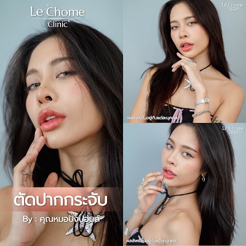 ตกแต่งริมฝีปาก
