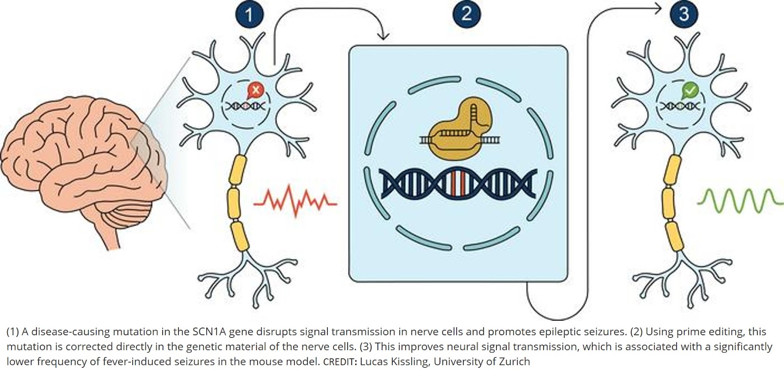 Hereditary epilepsy successfully treated in mouse model
