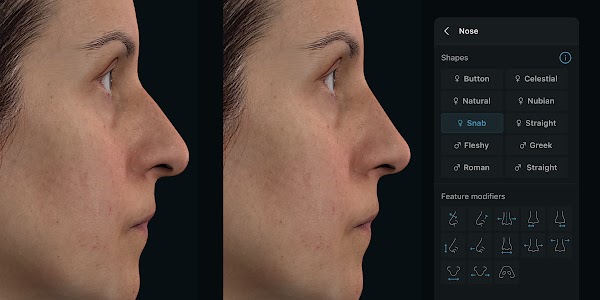 Simulation 3D des visages dans l’application Crisalix avec l’outil de procédure « Nose » ouvert. 2400px x 1200px.