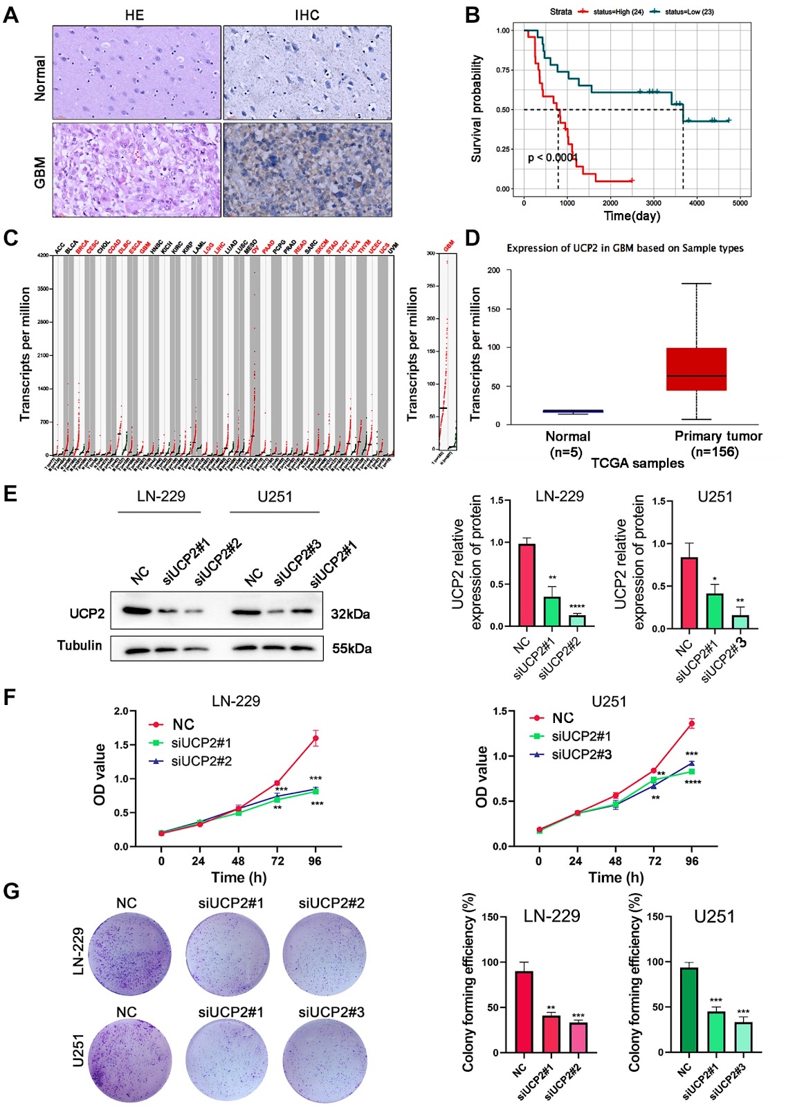 Repurposed genipin targeting UCP2 exhibits antitumor activity through inducing ferroptosis in glioblastoma