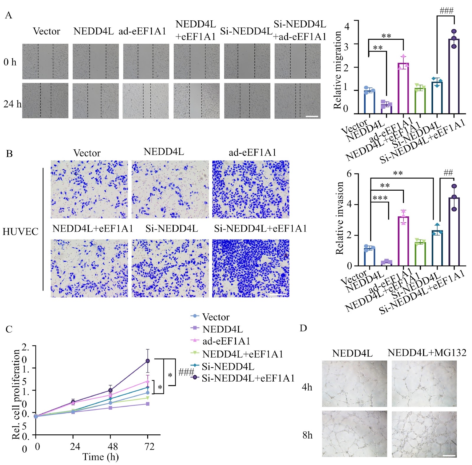 Therapeutic potential of targeting the NEDD4L-eEF1A1 axis in cancer therapy