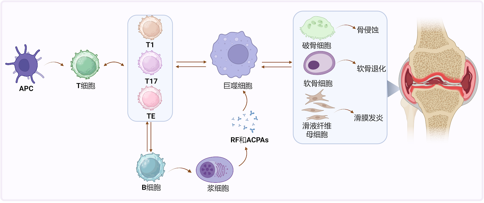 Hydrogel-based drug delivery systems for rheumatoid arthritis treatment