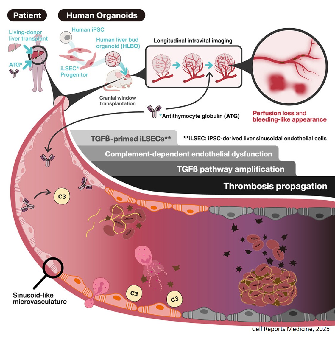 Modeling antithymocyte globulin-induced microvasculopathy using human iPSC-derived vascularized liver organoids