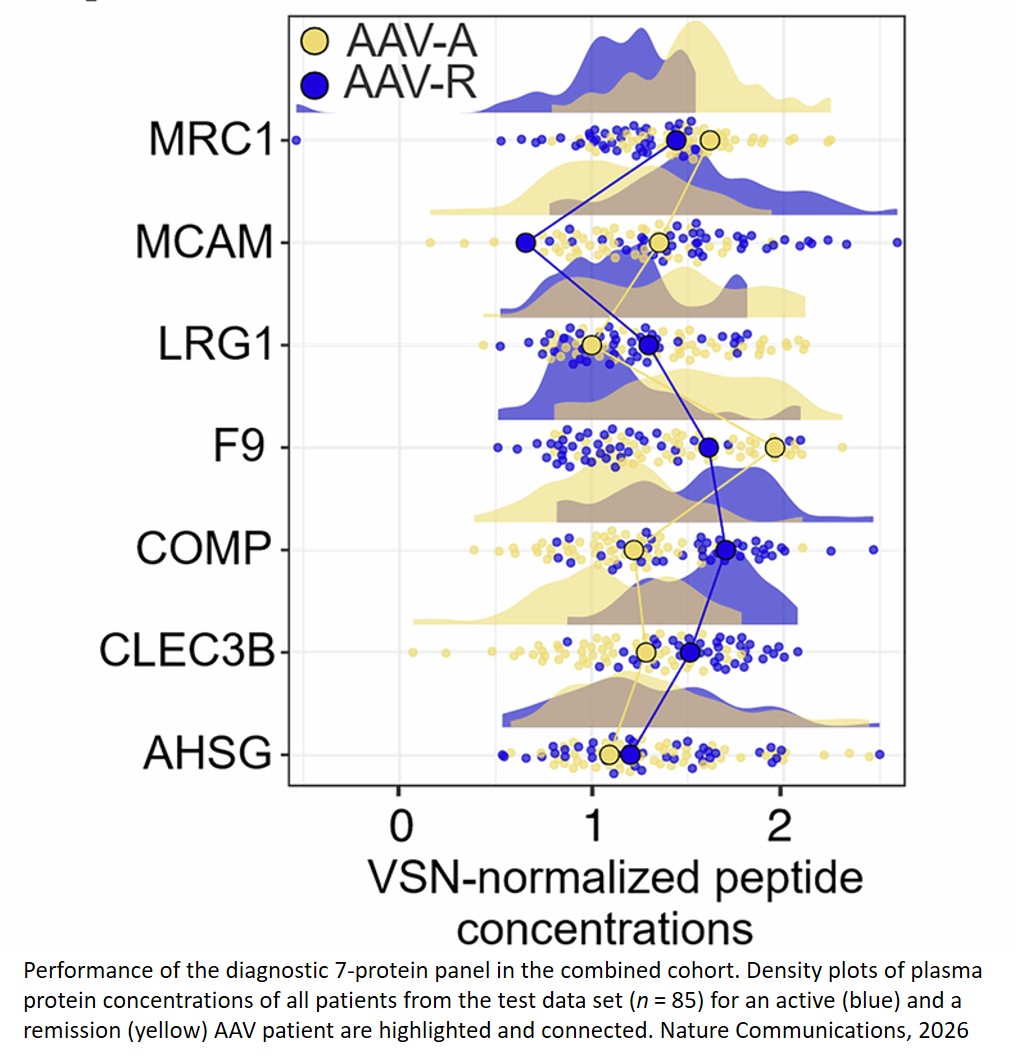 Proteomics and AI identify plasma biomarkers for vasculitis