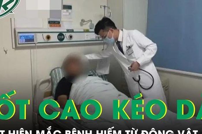 Sốt cao kéo dài không dứt, người đàn ông phát hiện mắc bệnh hiếm từ động vật - Báo Sức Khỏe &amp; Đời Sống