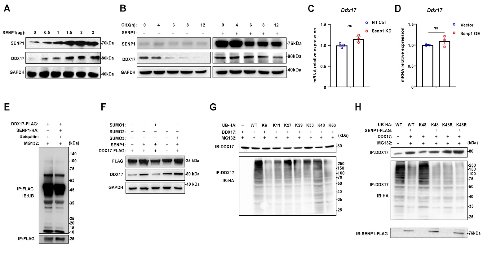 Carfilzomib triggers cardiotoxicity by suppressing SENP1-mediated deSUMOylation of DDX17