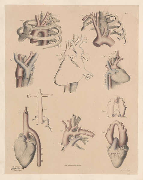 Peculiarities of the commencement of the Aortaaffecting its position direction a