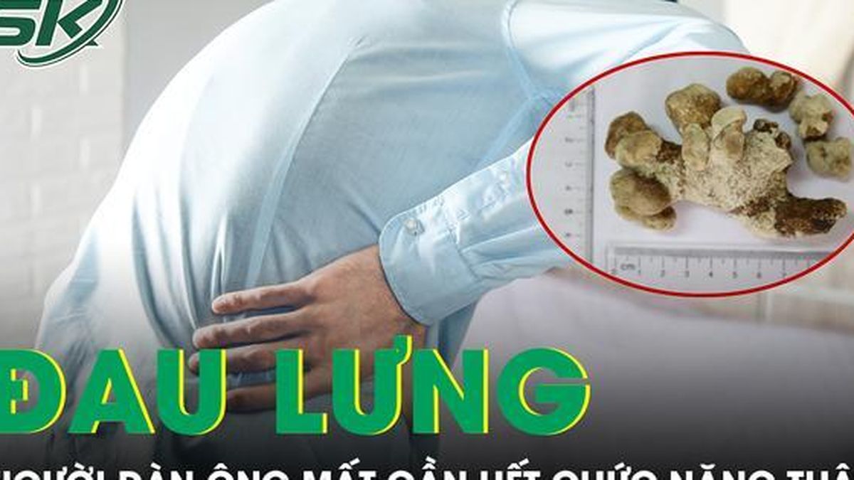 Người đàn ông mất gần hết chức năng thận do chủ quan với dấu hiệu đau lưng - Báo Sức Khỏe &amp; Đời Sống