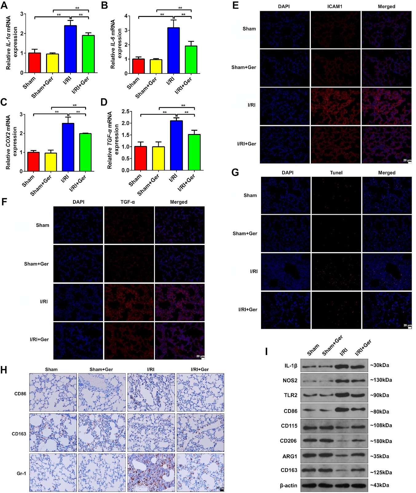 Germacrone ameliorates acute lung injury induced by intestinal ischemia-reperfusion by regulating macrophage M1 polarization and mitochondrial defects