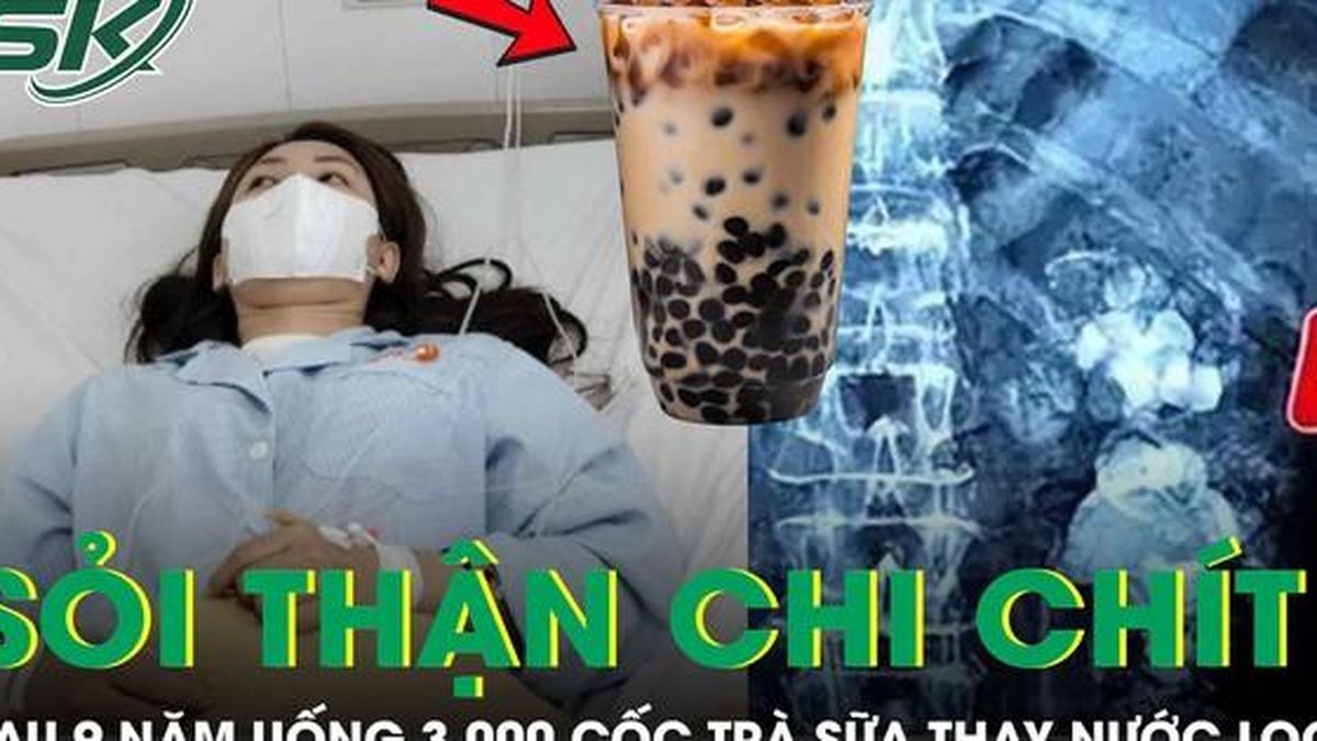 Uống 3.000 cốc trà sữa thay nước lọc suốt 9 năm, thận cô gái mọc chi chít sỏi - Báo Sức Khỏe &amp; Đời Sống