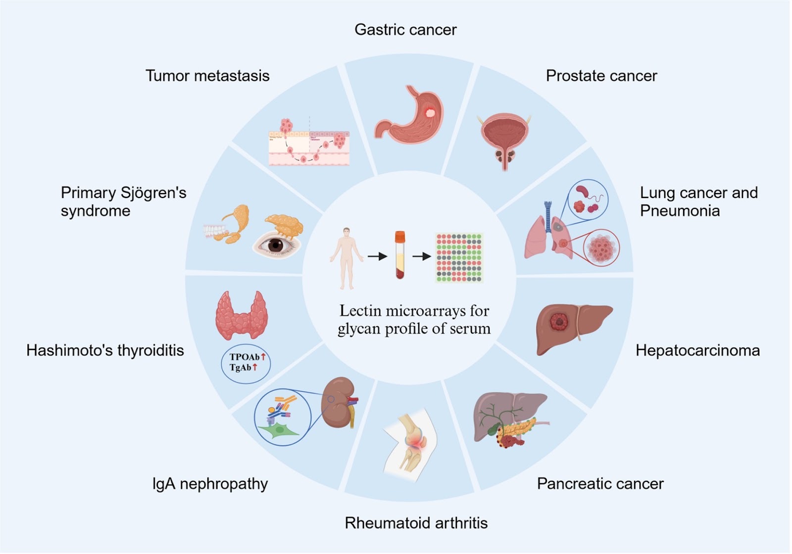 Deciphering disease through glycan codes: leveraging lectin microarrays for clinical insights