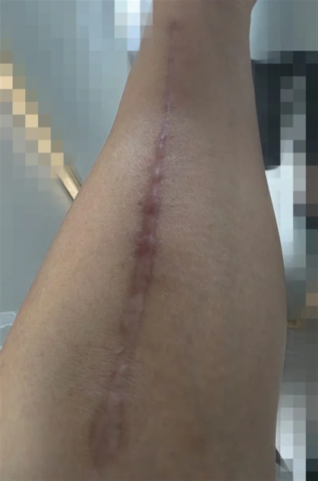 회복 중 재기를 준비하는 블로그 운영자의 실제 경험