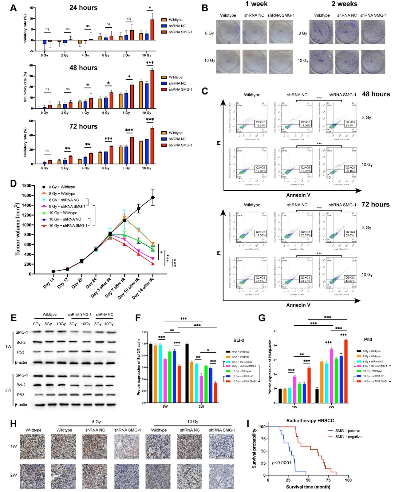 SMG-1 serves as a prognostic indicator for the radiotherapy response in head and neck squamous cell carcinoma xenografts and patients