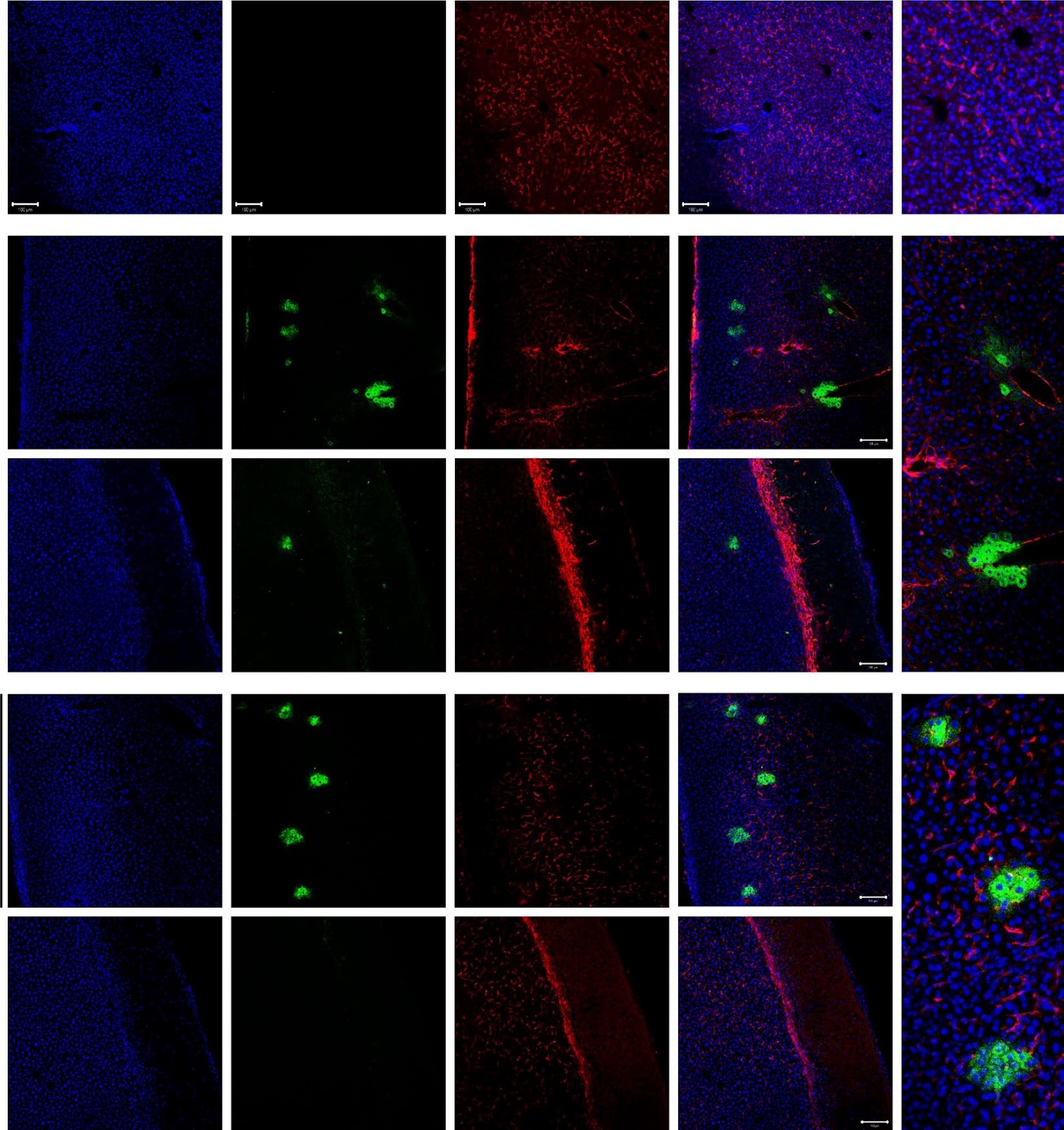 Kupffer cells abrogate homing and repopulation of allogeneic hepatic progenitors in injured liver site